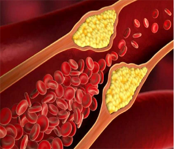 চর্বি, কোলেস্টেরল, ট্রাইগ্লিসারাইড